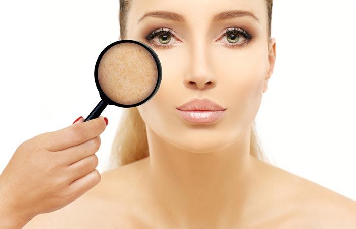 17 Surprising Ways To Use Vinegar For Your Skin 17 Surprising Ways To Use Vinegar For Your Skin
