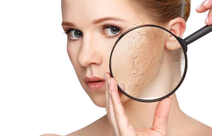 17 Surprising Ways To Use Vinegar For Your Skin 17 Surprising Ways To Use Vinegar For Your Skin