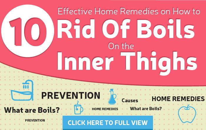 12 Home Remedies To Get Rid Of Boils On The Inner Thighs