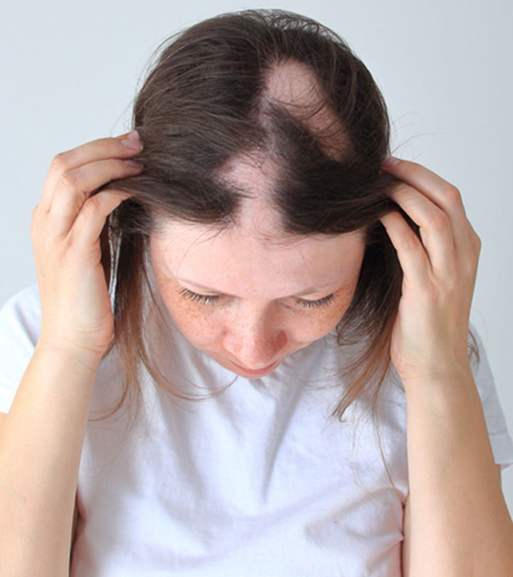 Aggregate More Than Do Hair Regrow After Falling Latest Dedaotaonec