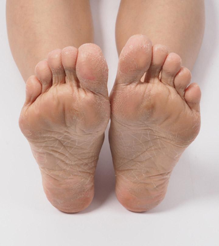 How to Get Dead Skin Off Your Feet: Tips, Prevention