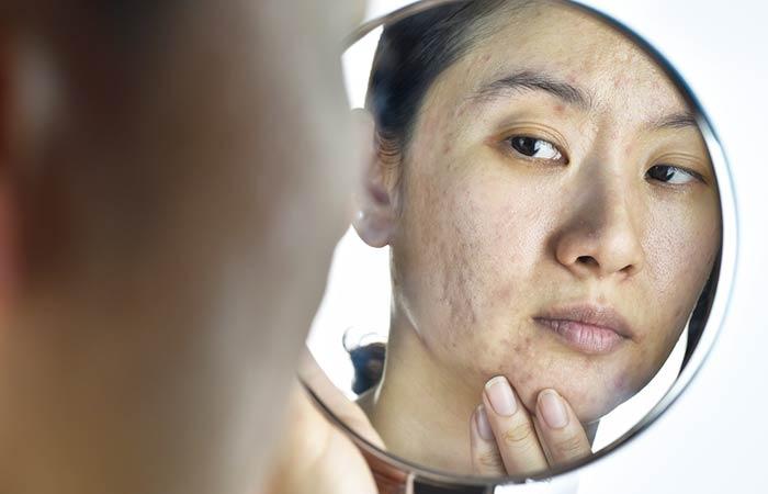 Post-Facelift Scar Camouflage With Permanent Cosmetics | Fabulously  Flawless Permanent Cosmetics
