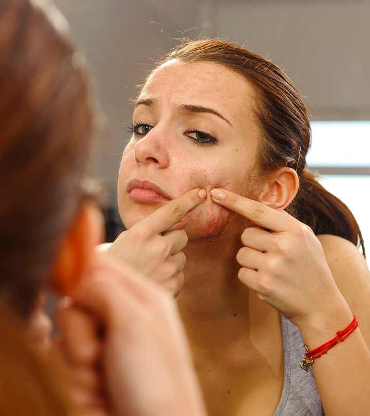7 Causes of Hyperpigmentation You Should Be Aware Of