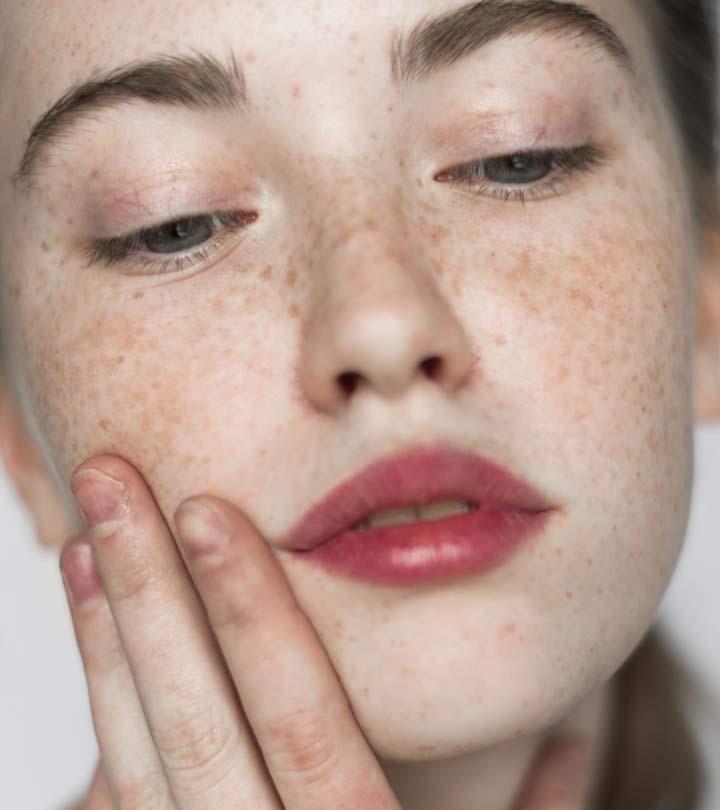 How Does Niacinamide Work to Reduce Melasma Symptoms?