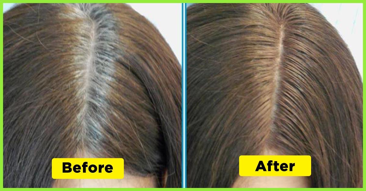 20 Simple Ways To Cover Gray Hair Naturally At Home 20 Simple Ways To Cover Gray Hair Naturally At Home