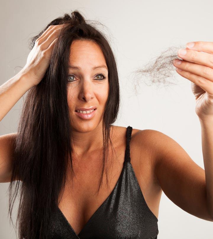 What Is Alopecia And How To Treat It Naturally