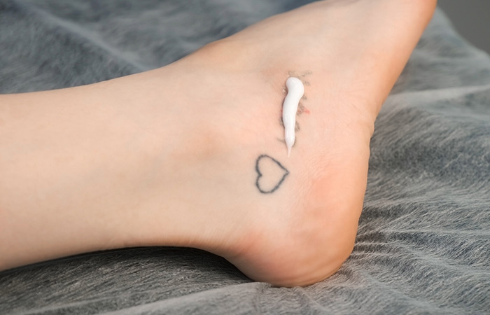 Unwanted Tattoos & Removal | Irvine, CA | Wellness by Dr. Elain