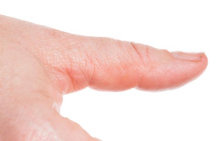 Brittle Nails: Causes & Risk Factors + 9 Natural Treatments - Dr. Axe