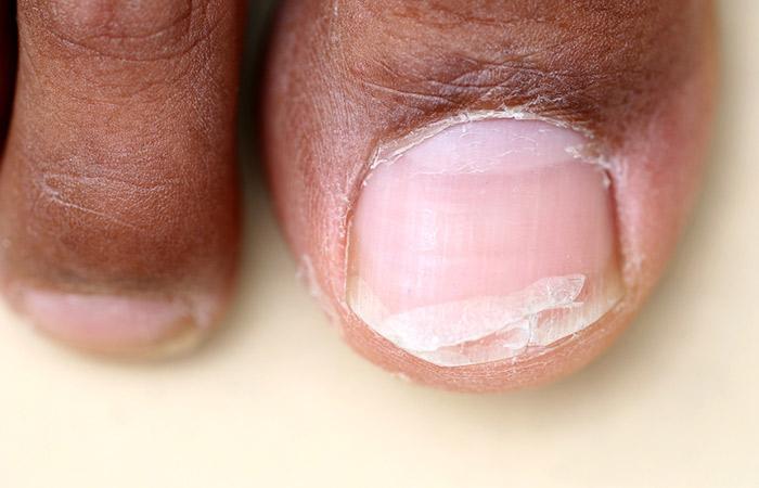 Can Vitamins and Minerals Strengthen Nails? | Houston Training Schools