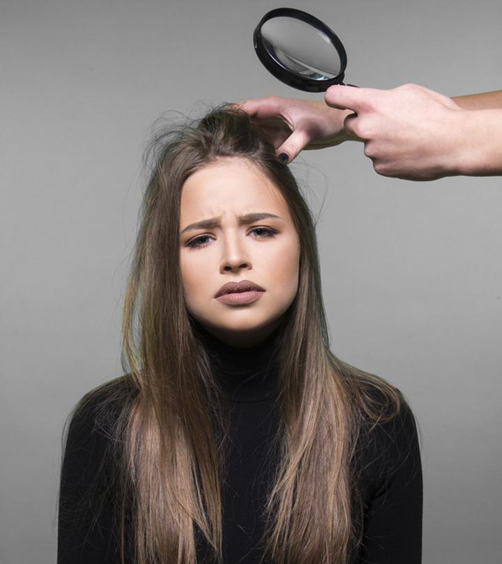 Can Dandruff Cause Hair Loss?