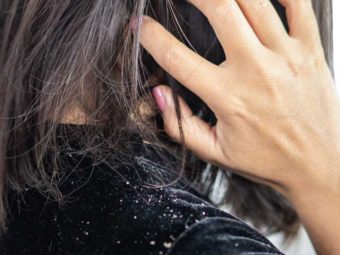 7 Best Hair Oils For Dandruff – Control The Itching & Flaking