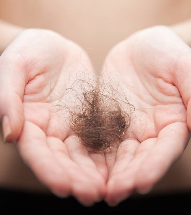Folliculitis Hair Loss – Causes, Precautions, And Treatment