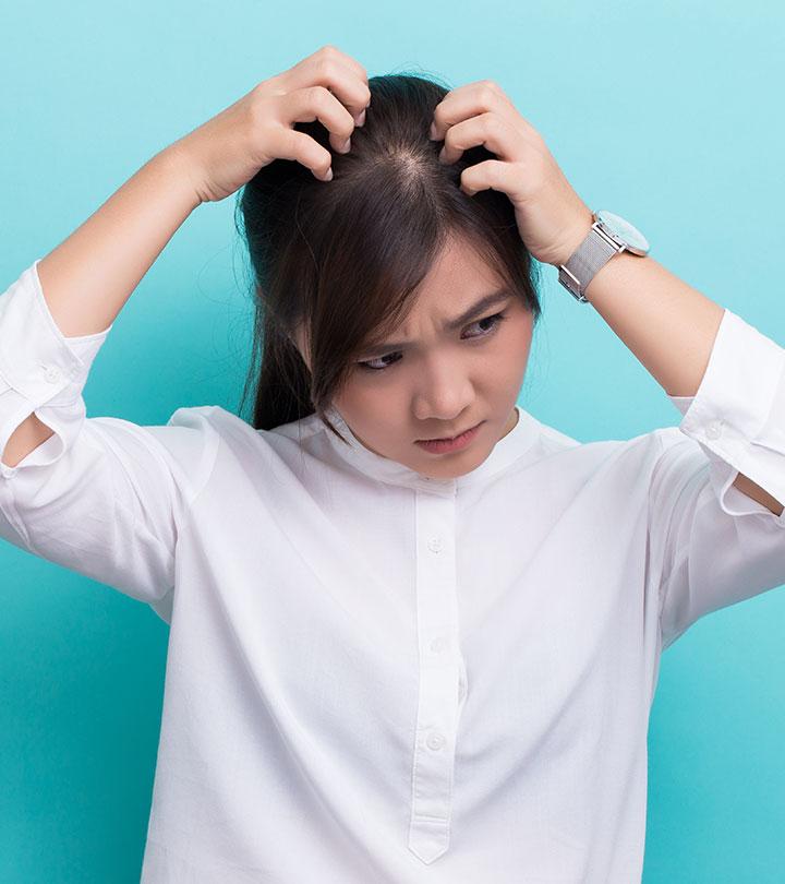 Wet Dandruff: What Is It And How To Treat It? - 5 Home Remedies