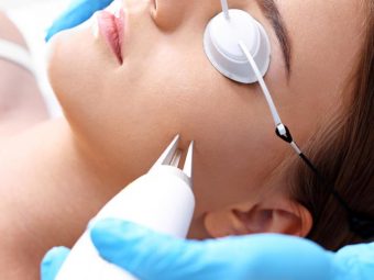 Laser Treatment For Acne Scars: Effect, Types, & How It Works