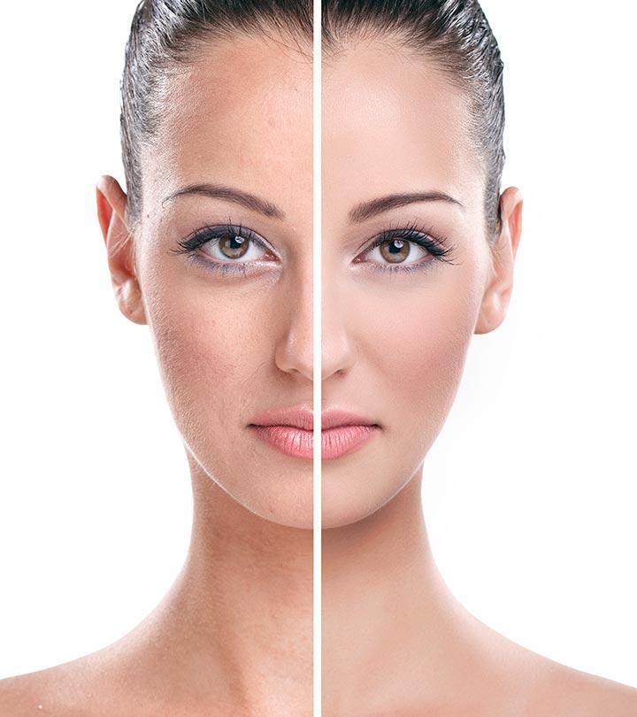 Skin rejuvenation clearance