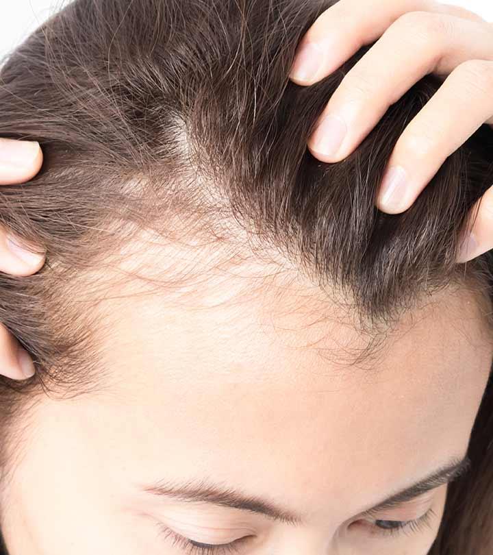 How to stop balding naturally increase