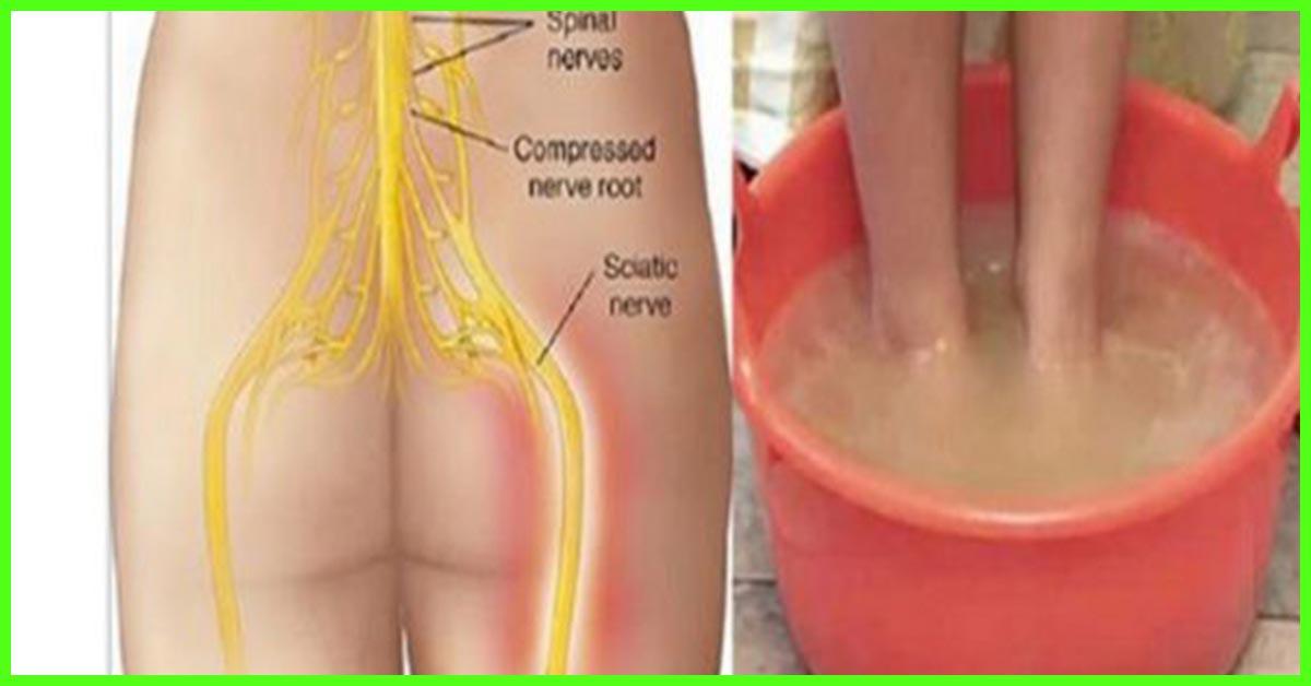 How to Reduce Sciatic Pain? 3 16 Effective Home Remedies To Relieve Sciatic Nerve Pain 1