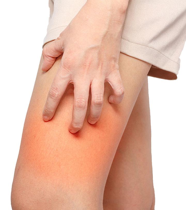 Chapped legs deals remedy