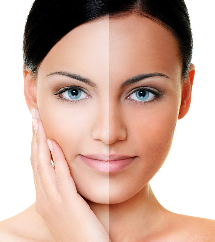 How To Remove Tan From The Face And Skin – 13 Remedies, Treatment Options + Tips