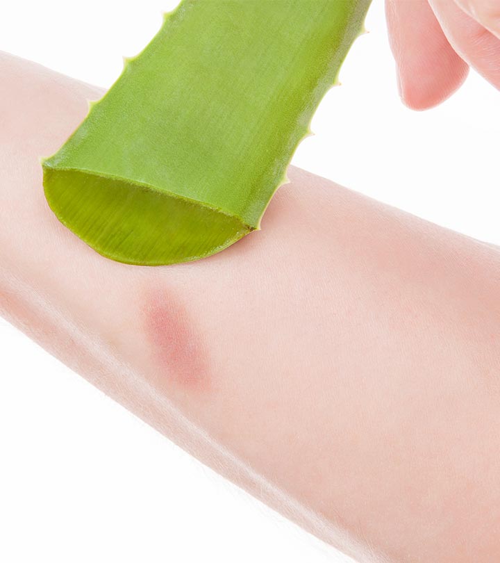 Top 10 Aloe Vera Gels For Treating Burns of 2023