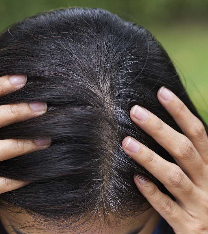Premature White and Grey Hair in Children: Causes & Home Remedies