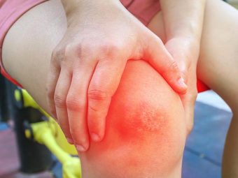 Home Remedies For Cellulitis - How To Treat It Without Antibiotics