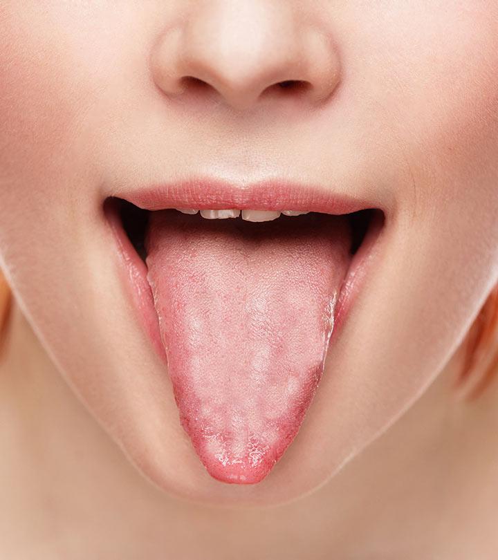 10 Effective Home Remedies For Furry Tongue