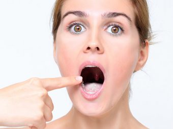 14 Home Remedies For White Tongue And Prevention Tips