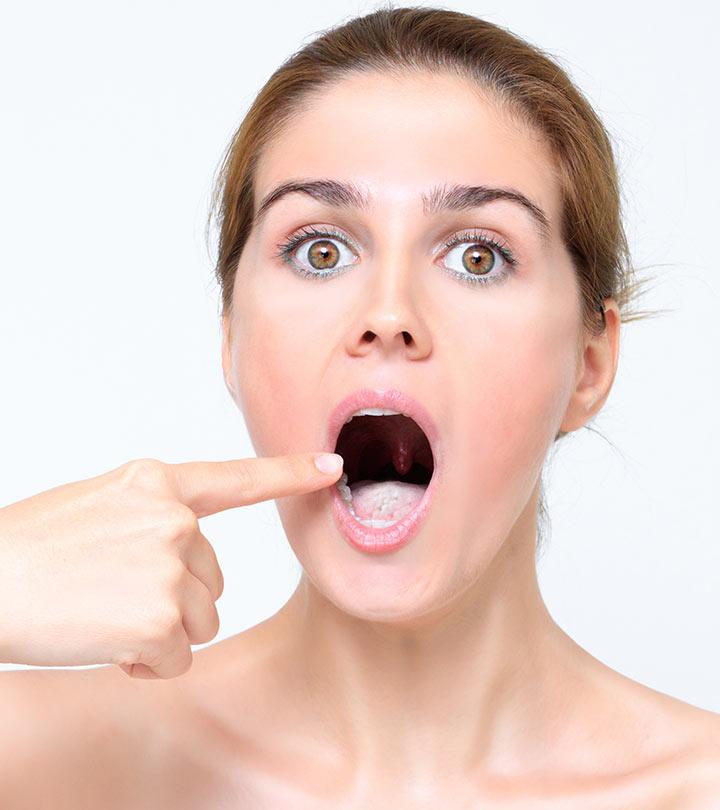 14 Home Remedies For White Tongue And Prevention Tips