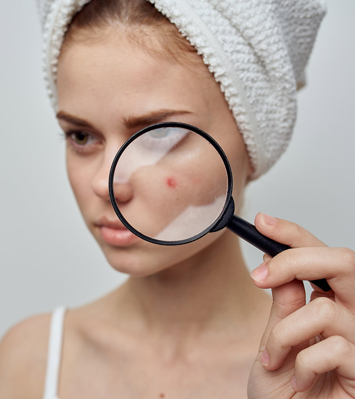 How To Use Vitamin E For Acne