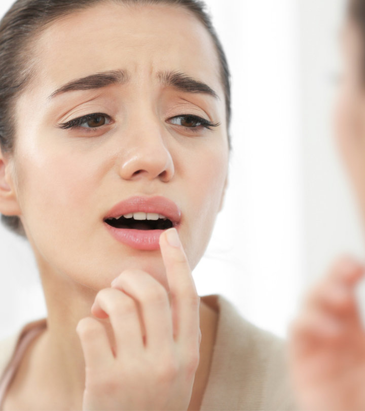 Is Hydrogen Peroxide A Cure For Cold Sores?