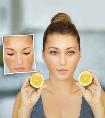 10 Home Remedies To Remove Dark Spots On Face With Lemon Juice