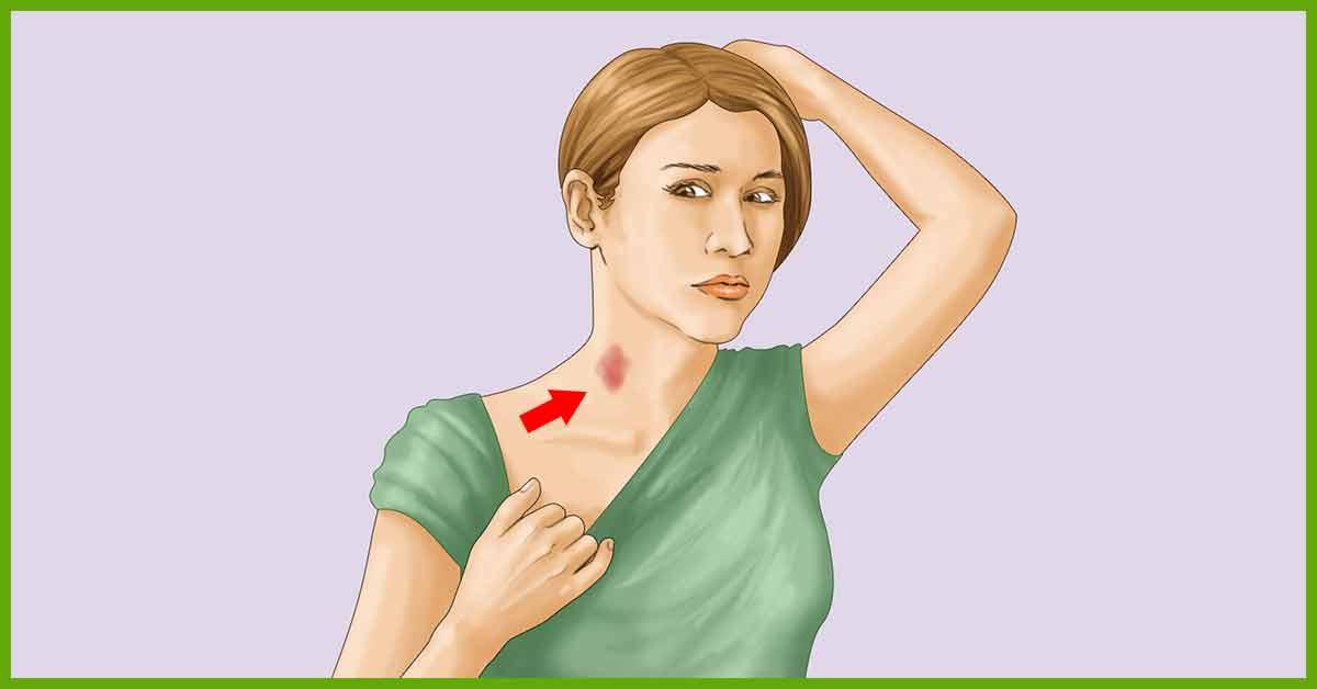 Hickey spoon