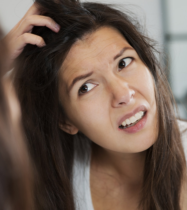 5 Common Questions On Dandruff Answered By Experts