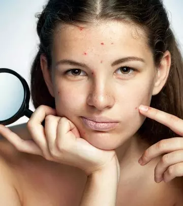 Best Home Remedies To Get Rid Of Skin Problems Naturally