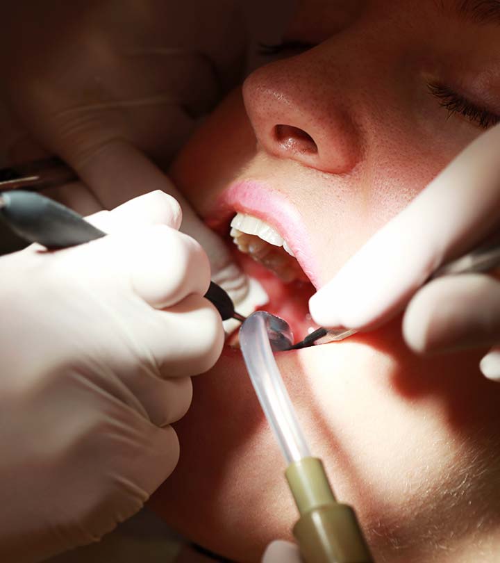 How A Root Canal Can Actually Affect Your Overall Health