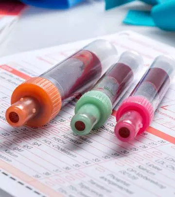 8 Unexpected Things A Blood Test Can Reveal About You