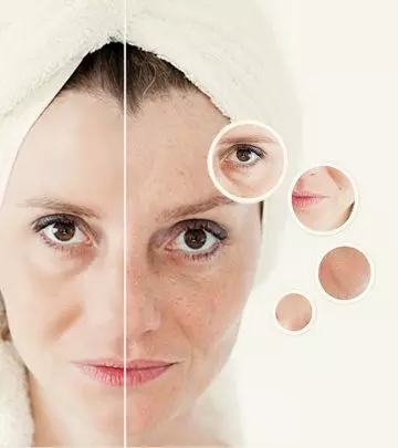 How To Get Rid Of Large Pores. Your Decision Depends On Your Age