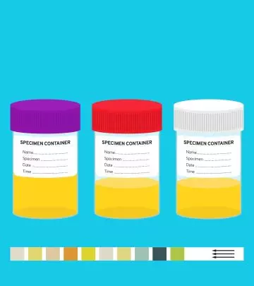 Ever Notice The Color Of Your Urine? Here’s What It Says About Your Body