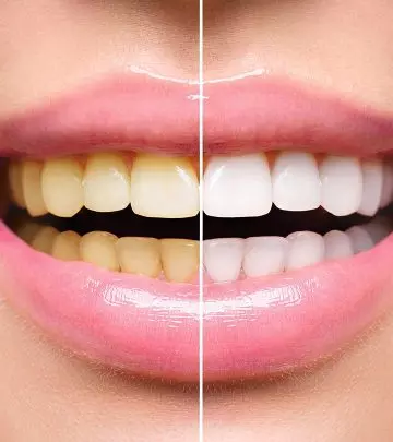Got Yellow Teeth? These 5 Remedies Will Work Like Magic!