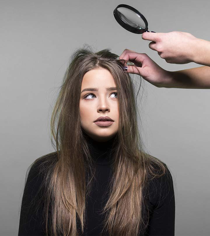 Best Anti-Dandruff Shampoos Available In India – Our Top 15