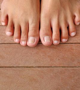 6 Options to Relieve Ingrown Toenail Pain at Home