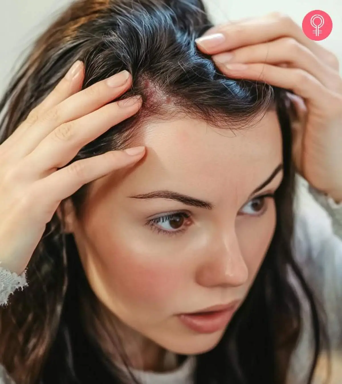Scab Picking Scalp
