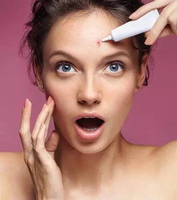 What You Don’t Know About Pimples