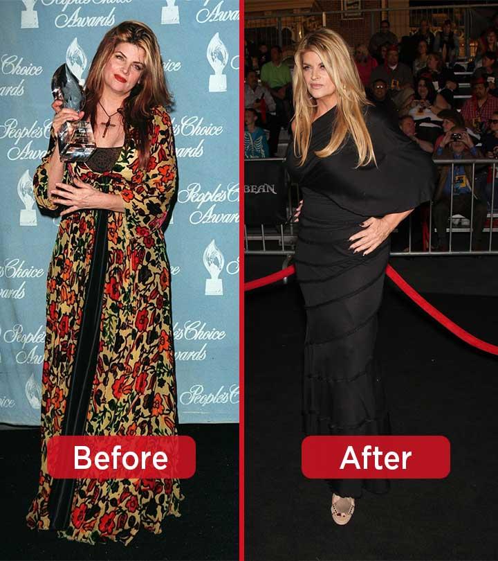 Kirstie Alley Weight Loss – Lose 50 Pounds Like This Star Trek Actress