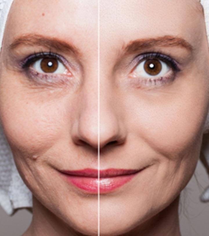 Why Large Pores Appear And How To Get Rid Of Them
