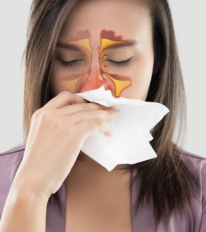 साइनस के लक्षण, कारण और घरेलू इलाज – Sinusitis Symptoms and Home Remedies in Hindi