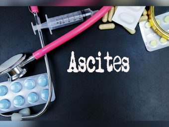 जलोदर के कारण, लक्षण, इलाज और घरेलू उपचार – Ascites Home Remedies in Hindi