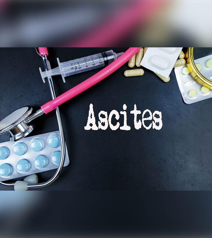 जलोदर के कारण, लक्षण, इलाज और घरेलू उपचार – Ascites Home Remedies in Hindi