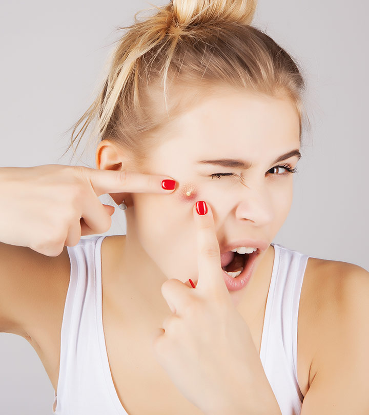 What Causes Acne — 7 Surprising Reasons Your Face Breaks Out